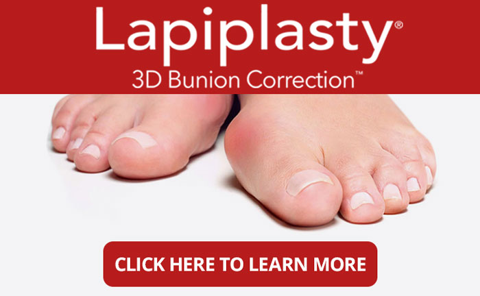 Lapiplasty Treatment in the Bergen County, NJ: Fair Lawn (Ridgewood, Glen Rock, Woodcliff Lake, Hillsdale, Westwood, Closter, Wyckoff, Ramsey, Oakland) and Englewood (Hackensack, Paramus, Tenafly, Closter, Northvale, East Rutherford); Morris County, NJ: Riverdale (Butler, Kinnelon, Montville, Boonton, Pequannock Township, Lincoln Park) as well as Passaic County, NJ (Hawthorne, Paterson, Clifton, Totowa, Pompton Lakes, Wanaque, Wayne, Macopin, Ringwood) and Hudson County, NJ (Secaucus, North Bergen) areas