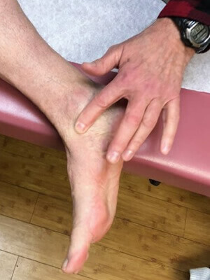 flat foot evaluation 5