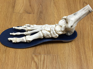 Custom Orthotics in the Bergen County, NJ: Fair Lawn (Ridgewood, Glen Rock, Woodcliff Lake, Hillsdale, Westwood, Closter, Wyckoff, Ramsey, Oakland) and Englewood (Hackensack, Paramus, Tenafly, Closter, Northvale, East Rutherford); Morris County, NJ: Riverdale (Butler, Kinnelon, Montville, Boonton, Pequannock Township, Lincoln Park) as well as Passaic County, NJ (Hawthorne, Paterson, Clifton, Totowa, Pompton Lakes, Wanaque, Wayne, Macopin, Ringwood) and Hudson County, NJ (Secaucus, North Bergen) areas