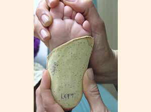 Pediatric Orthotics in the Bergen County, NJ: Fair Lawn (Ridgewood, Glen Rock, Woodcliff Lake, Hillsdale, Westwood, Closter, Wyckoff, Ramsey, Oakland) and Englewood (Hackensack, Paramus, Tenafly, Closter, Northvale, East Rutherford); Morris County, NJ: Riverdale (Butler, Kinnelon, Montville, Boonton, Pequannock Township, Lincoln Park) as well as Passaic County, NJ (Hawthorne, Paterson, Clifton, Totowa, Pompton Lakes, Wanaque, Wayne, Macopin, Ringwood) and Hudson County, NJ (Secaucus, North Bergen) areas