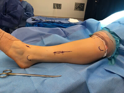 nerve repair specialist in the Bergen County, NJ: Fair Lawn (Ridgewood, Glen Rock, Woodcliff Lake, Hillsdale, Westwood, Closter, Wyckoff, Ramsey, Oakland) and Englewood (Hackensack, Paramus, Tenafly, Closter, Northvale, East Rutherford); Morris County, NJ: Riverdale (Butler, Kinnelon, Montville, Boonton, Pequannock Township, Lincoln Park) as well as Passaic County, NJ (Hawthorne, Paterson, Clifton, Totowa, Pompton Lakes, Wanaque, Wayne, Macopin, Ringwood) and Hudson County, NJ (Secaucus, North Bergen) areas
