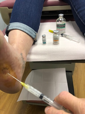 Needling technique treatmen in the Bergen County, NJ: Fair Lawn (Ridgewood, Glen Rock, Woodcliff Lake, Hillsdale, Westwood, Closter, Wyckoff, Ramsey, Oakland) and Englewood (Hackensack, Paramus, Tenafly, Closter, Northvale, East Rutherford); Morris County, NJ: Riverdale (Butler, Kinnelon, Montville, Boonton, Pequannock Township, Lincoln Park) as well as Passaic County, NJ (Hawthorne, Paterson, Clifton, Totowa, Pompton Lakes, Wanaque, Wayne, Macopin, Ringwood) and Hudson County, NJ (Secaucus, North Bergen) areas