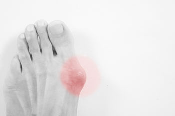 Foot Doctor, podiatrist in the Bergen County, NJ: Fair Lawn (Ridgewood, Glen Rock, Woodcliff Lake, Hillsdale, Westwood, Closter, Wyckoff, Ramsey, Oakland) and Englewood (Hackensack, Paramus, Tenafly, Closter, Northvale, East Rutherford); Morris County, NJ: Riverdale (Butler, Kinnelon, Montville, Boonton, Pequannock Township, Lincoln Park) as well as Passaic County, NJ (Hawthorne, Paterson, Clifton, Totowa, Pompton Lakes, Wanaque, Wayne, Macopin, Ringwood) and Hudson County, NJ (Secaucus, North Bergen) areas