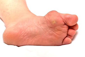 Foot DOctor, Podiatrist in the Bergen County, NJ: Fair Lawn (Ridgewood, Glen Rock, Woodcliff Lake, Hillsdale, Westwood, Closter, Wyckoff, Ramsey, Oakland) and Englewood (Hackensack, Paramus, Tenafly, Closter, Northvale, East Rutherford); Morris County, NJ: Riverdale (Butler, Kinnelon, Montville, Boonton, Pequannock Township, Lincoln Park) as well as Passaic County, NJ (Hawthorne, Paterson, Clifton, Totowa, Pompton Lakes, Wanaque, Wayne, Macopin, Ringwood) and Hudson County, NJ (Secaucus, North Bergen) areas