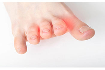 Morton's Neuroma Treatment in the Bergen County, NJ: Fair Lawn (Ridgewood, Glen Rock, Woodcliff Lake, Hillsdale, Westwood, Closter, Wyckoff, Ramsey, Oakland) and Englewood (Hackensack, Paramus, Tenafly, Closter, Northvale, East Rutherford); Morris County, NJ: Riverdale (Butler, Kinnelon, Montville, Boonton, Pequannock Township, Lincoln Park) as well as Passaic County, NJ (Hawthorne, Paterson, Clifton, Totowa, Pompton Lakes, Wanaque, Wayne, Macopin, Ringwood) and Hudson County, NJ (Secaucus, North Bergen) areas