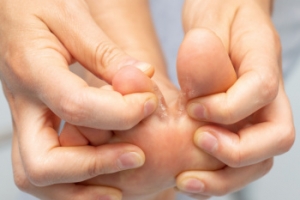 What Happens if Athlete&#039;s Foot Is Untreated