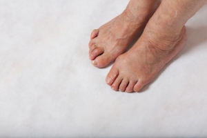 Exercises for Hammertoe