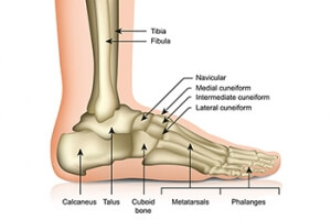 What Can Cause a Stress Fracture?