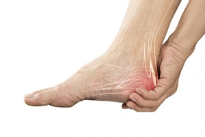 Causes and Symptoms of Plantar Fasciitis