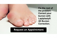 Painful Bunions? There's a New Treatment Option in Lapiplasty®