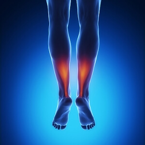 How Do Achilles Tendon Injuries Happen?