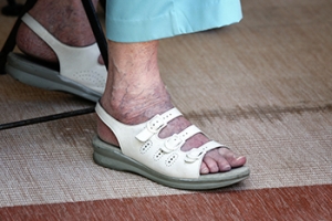 Choosing Shoes for Arthritic Feet