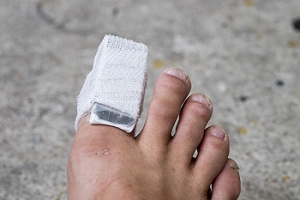 How Can I Treat My Broken Toe?