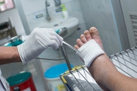 Prompt Treatment of Diabetic Wounds