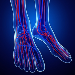 What Causes Poor Circulation?