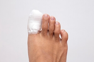 How Do Broken Toes Occur?