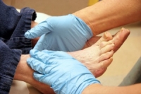 Diabetic Feet Need Frequent Exams